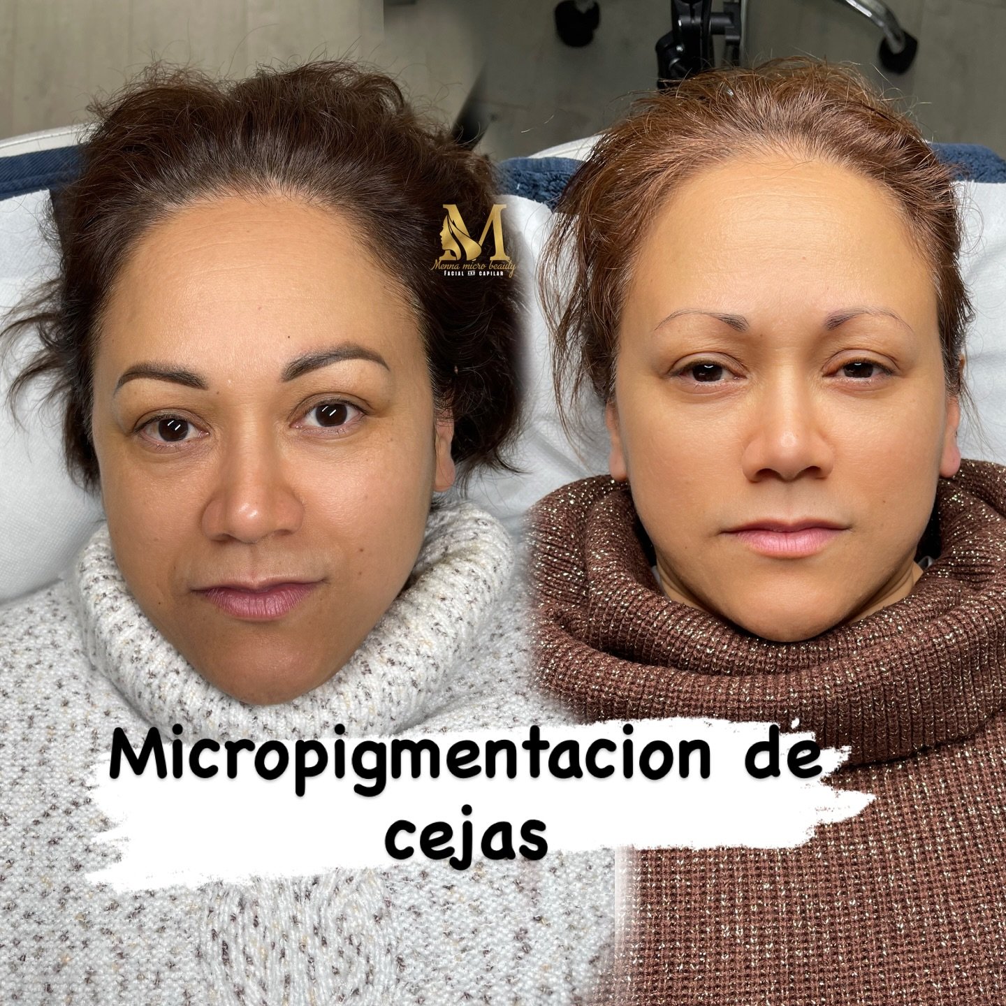 Micropigmentación - Resultado 2